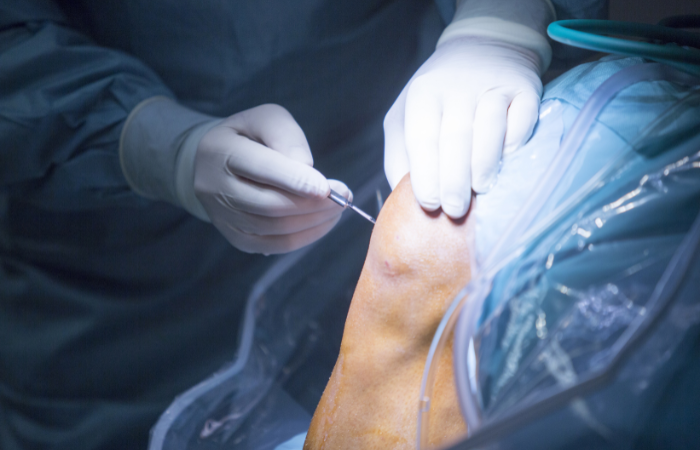 Orthopedics